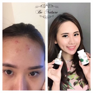 Cám gạo di băng