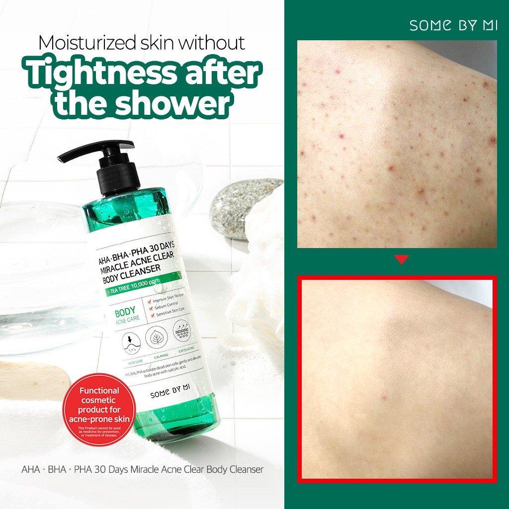 Sữa Tắm Giảm Mụn Lưng Some By Mi AHA BHA PHA 30 Days Miracle Acne Body Cleanser 400ml