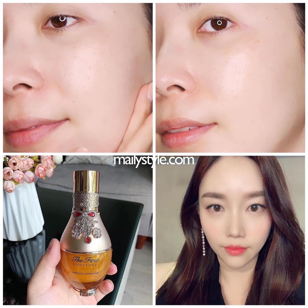 Tinh chất vàng OHUI THE FIRST tái tạo, phục hồi da | BigBuy360 - bigbuy360.vn