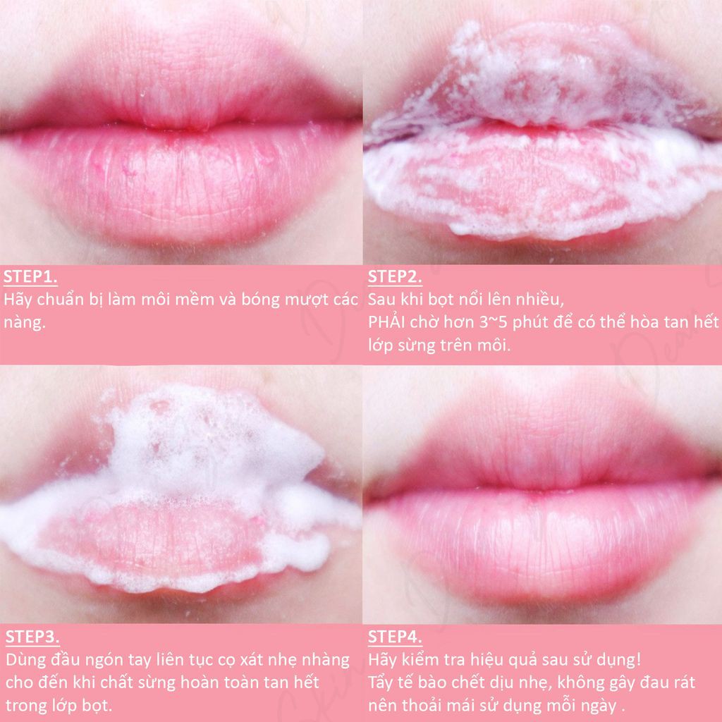 GEL TẨY DA CHẾT MÔI BUBI BUBI LIP UNPA..