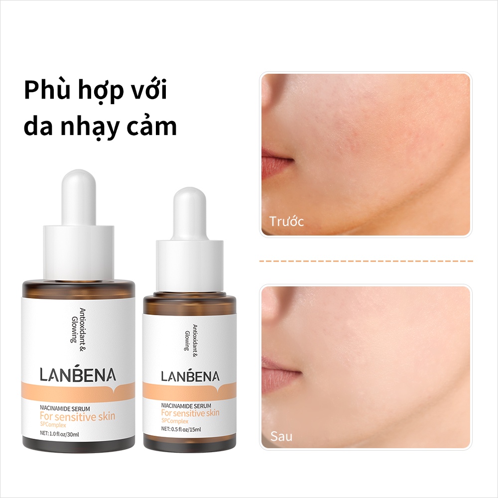 Tinh Chất Làm Trắng Serum Niacinamide Vitamin C Lanbena Làm Sáng Da Giảm Vết Thâm Và Làm Săn Chắc Da