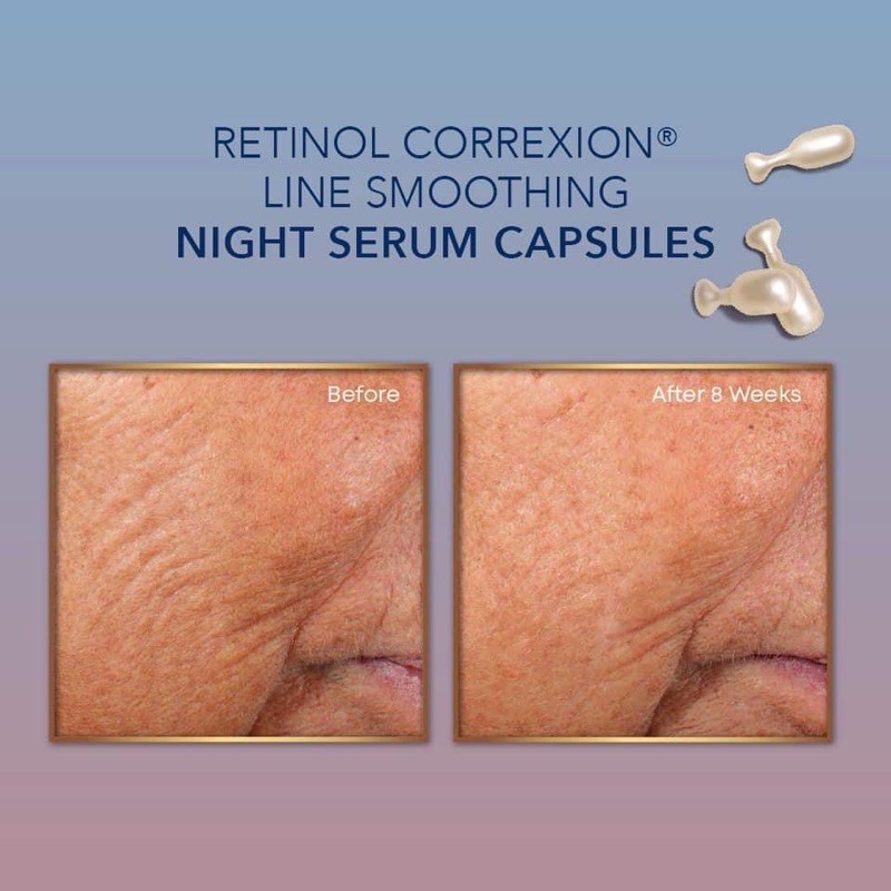 [Mã COS1904 giảm 8% đơn 300K] [SĂN SALE] Kem mắt Roc và tinh chất chống lão hoá - Bill Mỹ | BigBuy360 - bigbuy360.vn