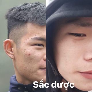 Sắc dược đông y