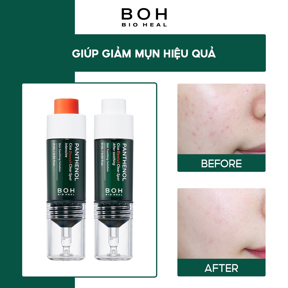 Bộ Sản Phẩm Chăm Sóc Da Mụn BIOHEAL BOH Panthenol Cica Blemish Clear Spot 9ml* 2 (NEW)