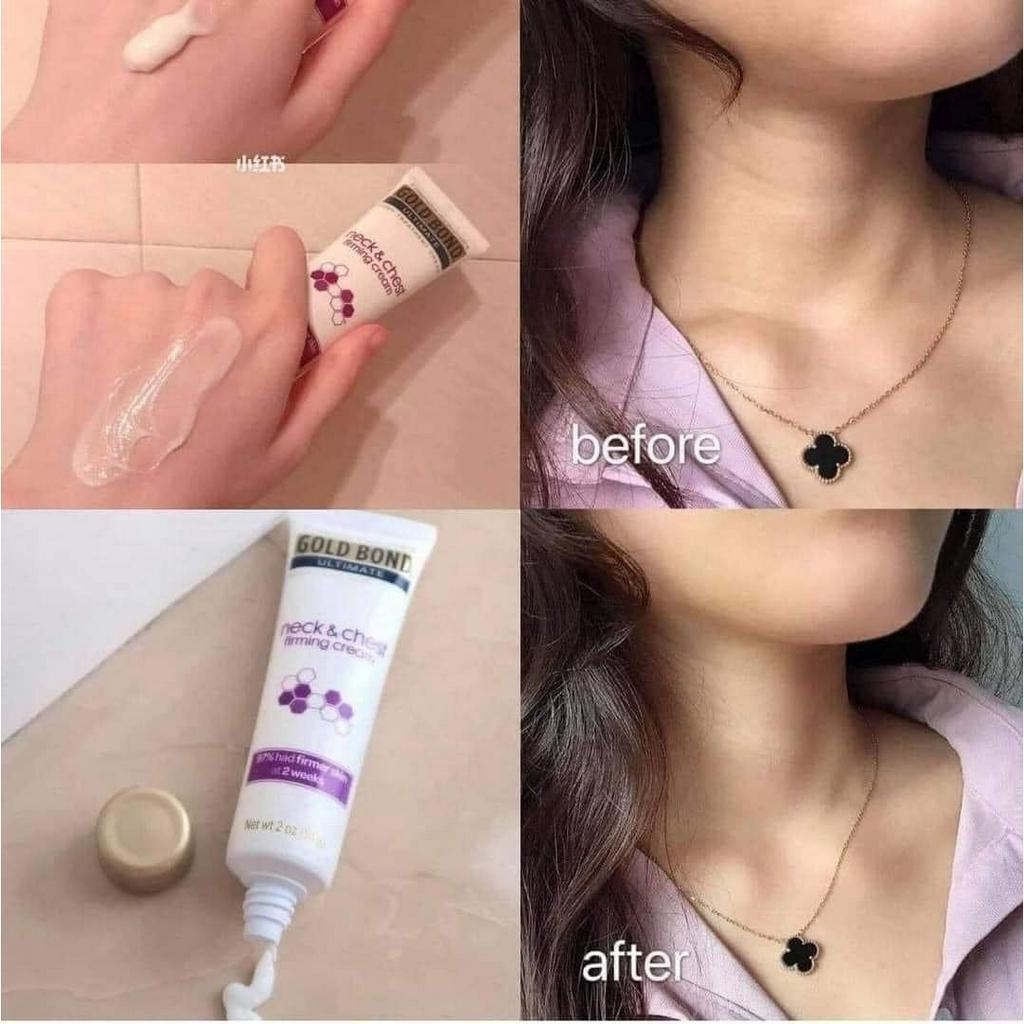 Kem Dưỡng Đẩy Lùi Lão Hóa Cho Vùng Cổ & Ngực Gold Bond Ultimate Neck & Chest Firming Cream 56g