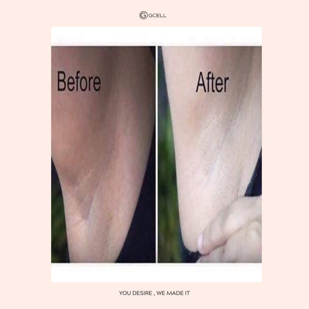 KEM LÀM TRẮNG NÁCH BẸN MÔNG GCELL XXVIRGIN A6