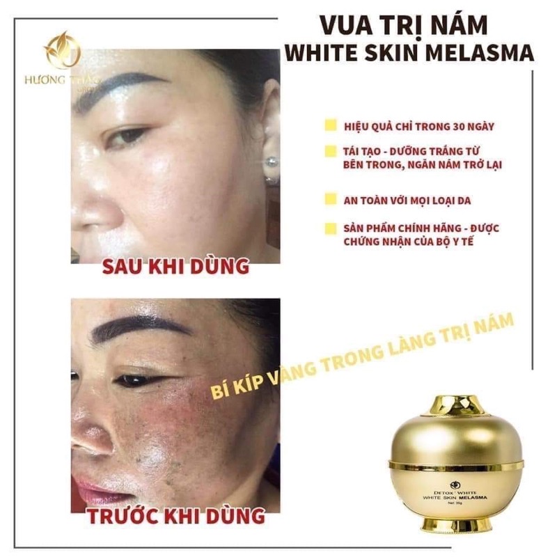 KEM NÁM DETOX WHITE [Huong Thảo Group)