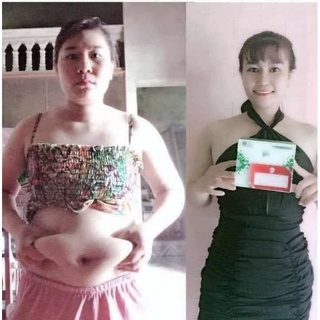 𝗧𝗵𝘂𝗼̂́𝗰 𝗴𝗶𝗮̉𝗺 𝗰𝗮̂𝗻 𝘁𝗵𝗮ỏ mộc