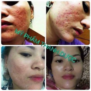 MỸ PHẨM THANH DƯỢC (SERUM LÁRE LỌ 80ML)