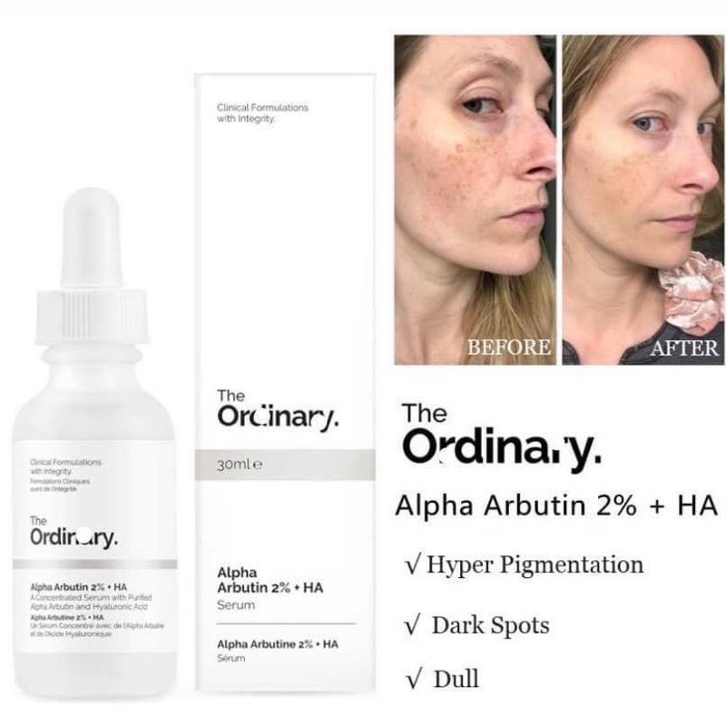 [THE ORDINARY] Tinh chất trắng da mờ thâm The Ordinary Alpha Arbutin 2% + HA 30ml