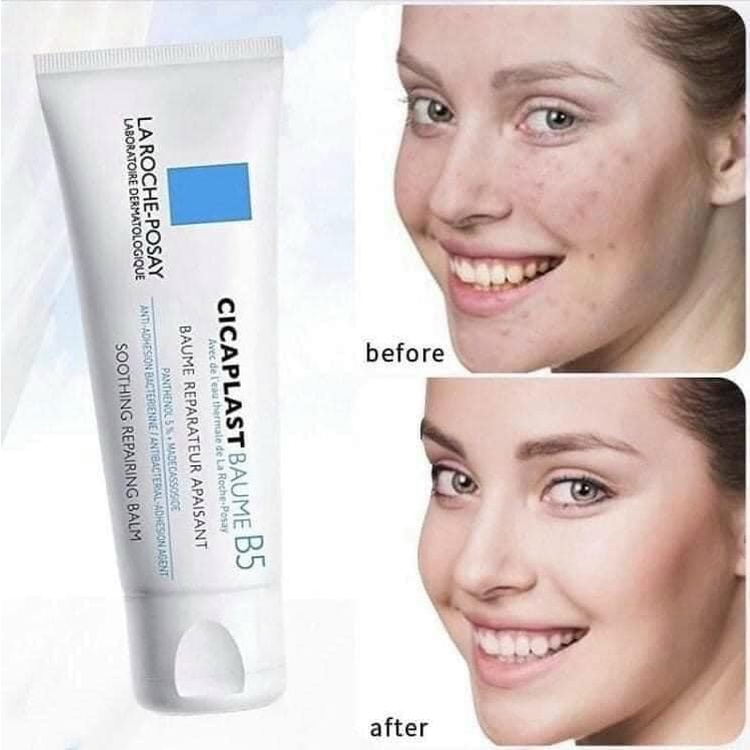 La Roche Posay - Kem ngừa mụn Cicaplast Baume B5 40ml và 100ml