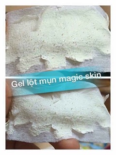 Gel lột mụn đầu đen