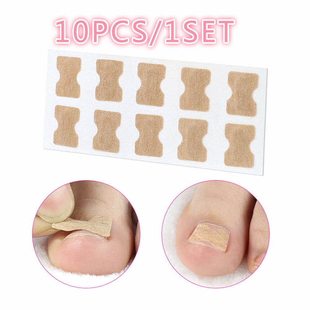 10PCS Non-Glue Toenail Patch Ingrown Toenail Correction Pedicure Tool