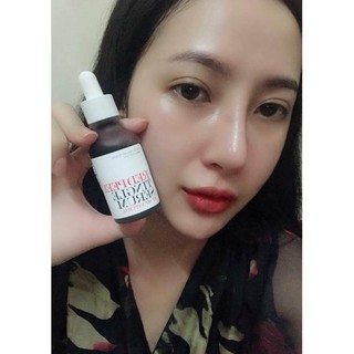 Serum thay da sinh học red peel, tinh chất trắng da
