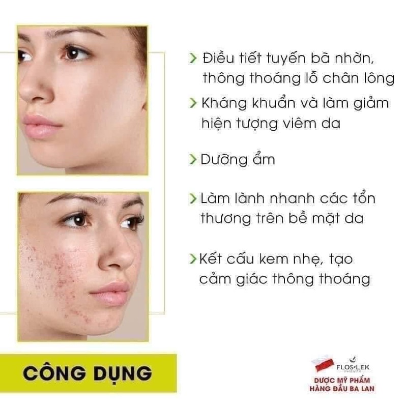 Kem dưỡng kiểm soát dầu Floslek Anti Acne Mattifying Cream