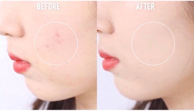 [Order] I’m MeMe Genius Foundation | BigBuy360 - bigbuy360.vn