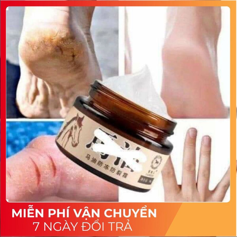 Kem Dầu Ngựa Nứt Gót Chân, Nẻ Da Tay Hàng Chất Lượng 30gr