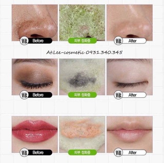 Super Vegitoks Cleanser sữa rửa mặt