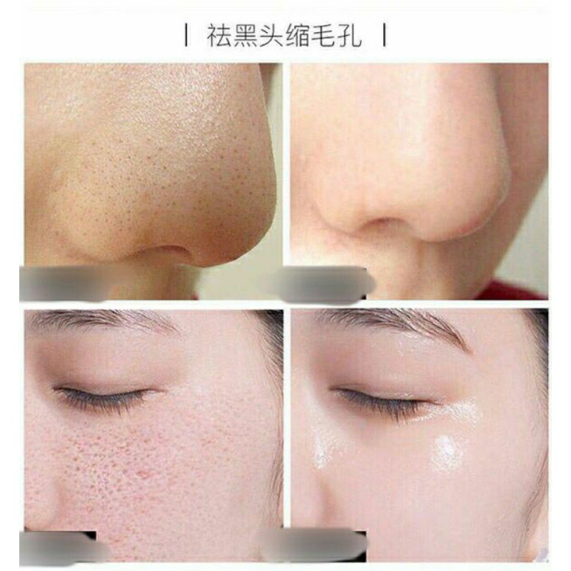 [RẺ VÔ ĐỊCH]Tinh Chất Shrinkage Pore Dưỡng Da Thu Nhỏ lỗ Chân Lông 30ml