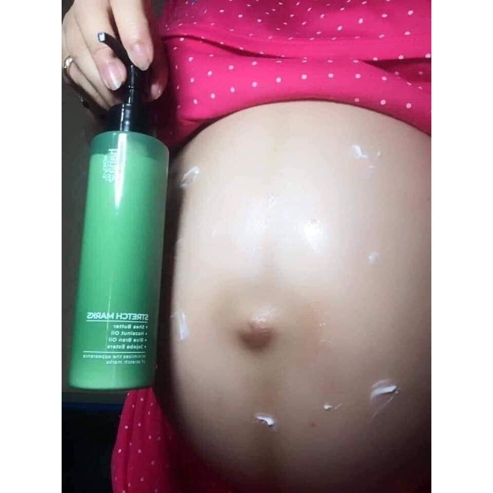 Kem rạn da Riori Stretch Marks | BigBuy360 - bigbuy360.vn