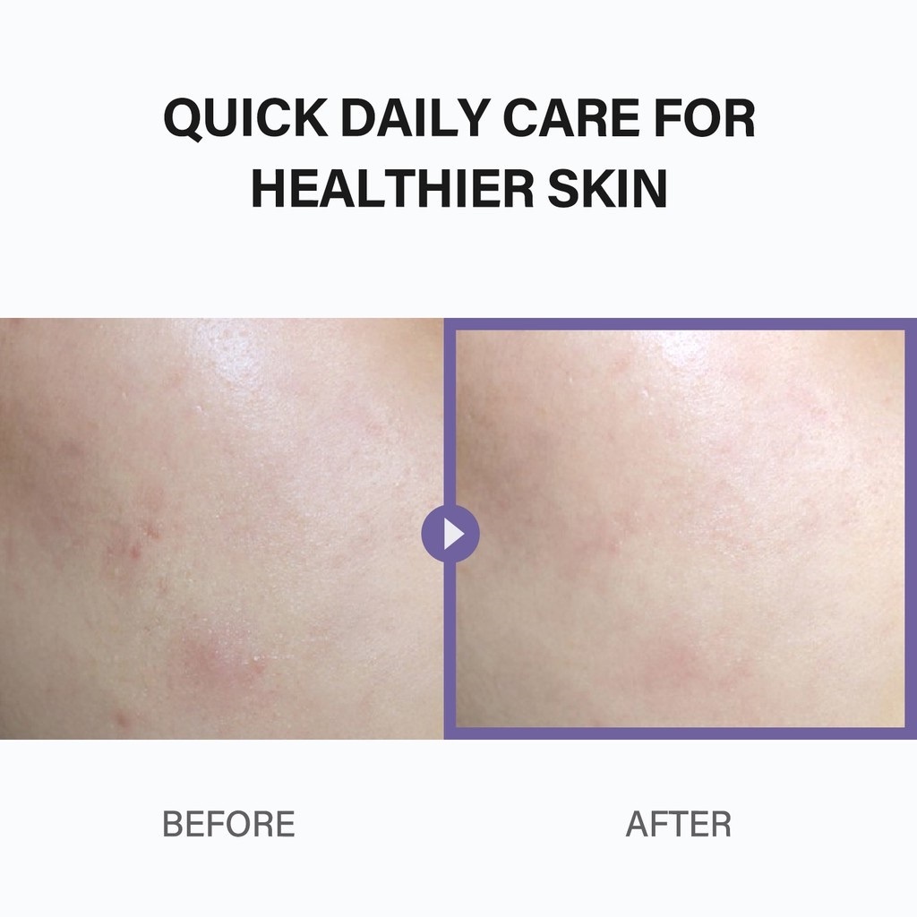 Bông tẩy tế bào chết chứa BHA CELIMAX Heartleaf 125ml