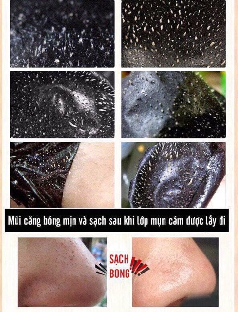 1 LỌ LỘT MỤN THAN TRE | BigBuy360 - bigbuy360.vn