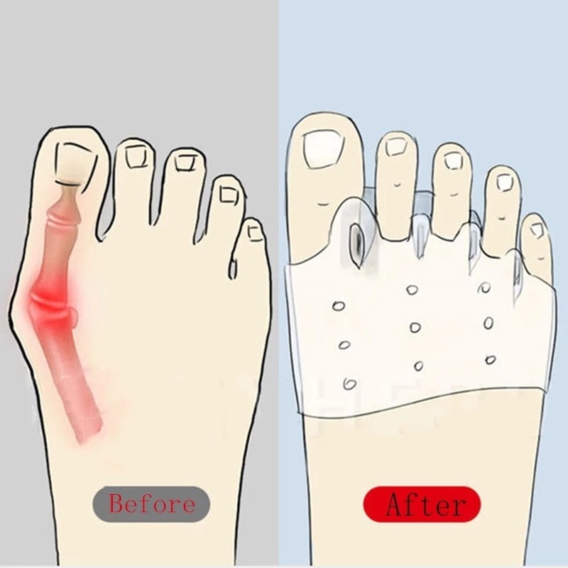 1 Cặp Đệm Silicon Mềm Hình Tổ Ong Lót Nửa Bàn Chân Giảm Đau