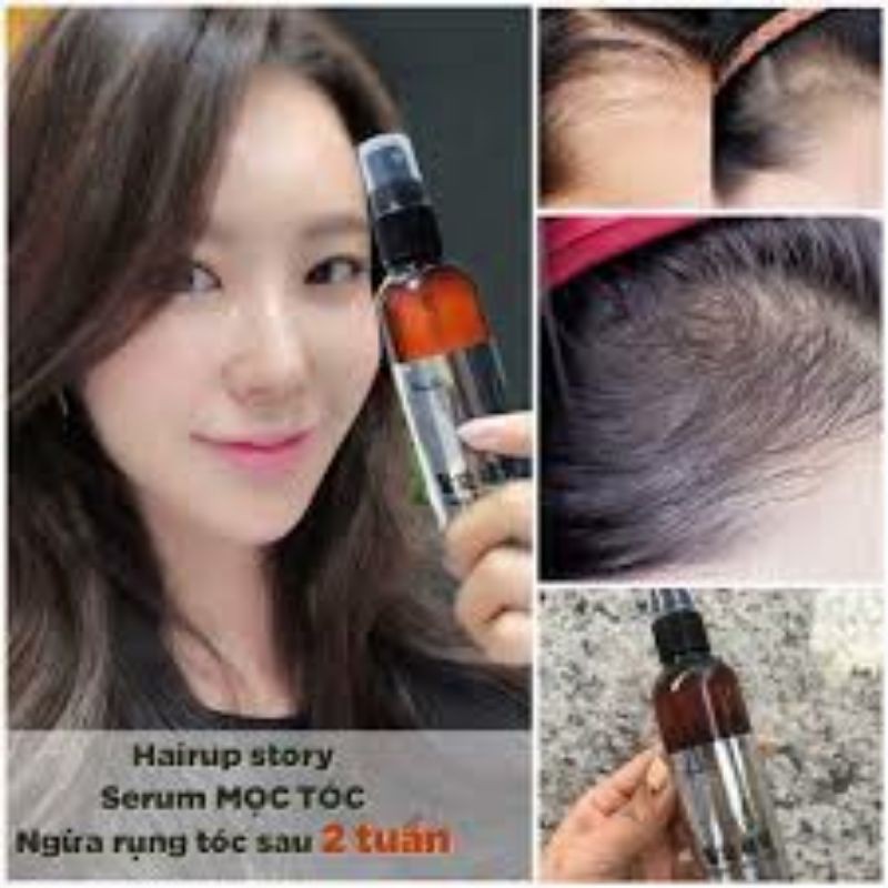 XỊT MỌC TÓC GENIE HAIR UP STORY PARIS CHOI ❤️FREESHIP❤️