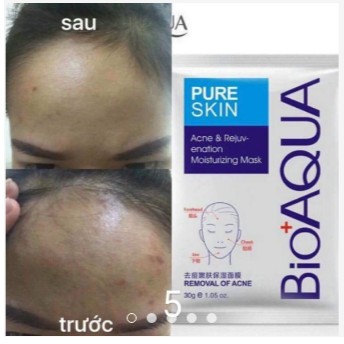 Mặt nạ mụn - Bioaqua Pure Skin