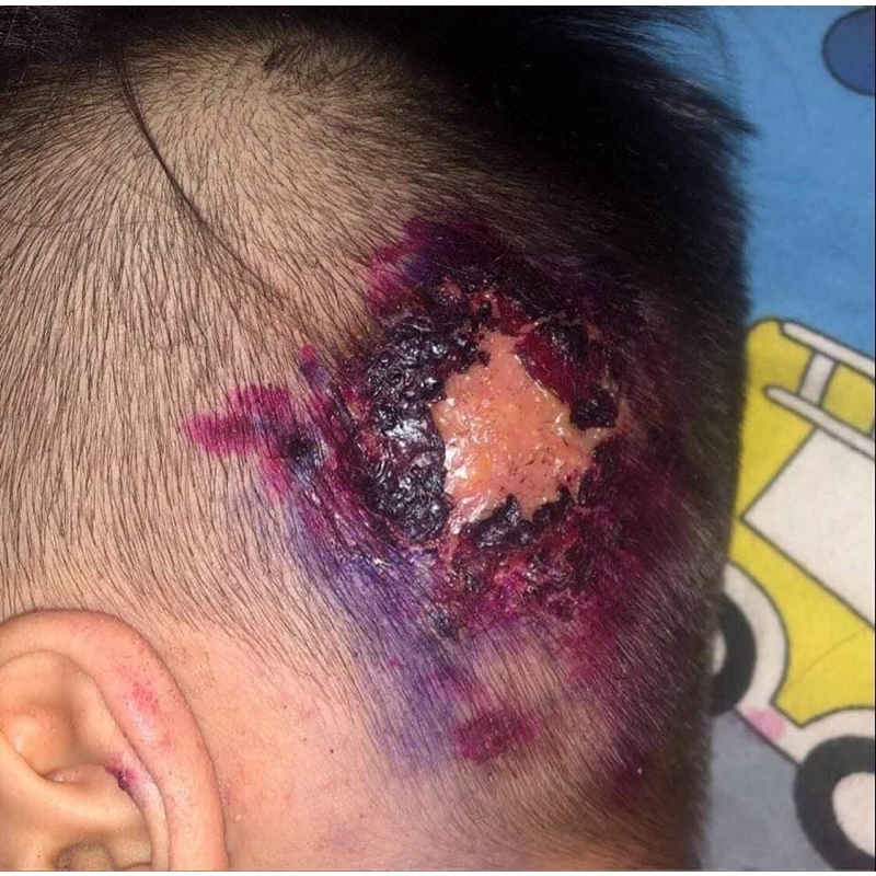 Dầu Minh Ngọc cầm máu, nhanh lành vết thương 30ml- JET Natural Store