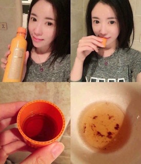 Nước xúc miệng PROPOLINSE - Nhật Bản