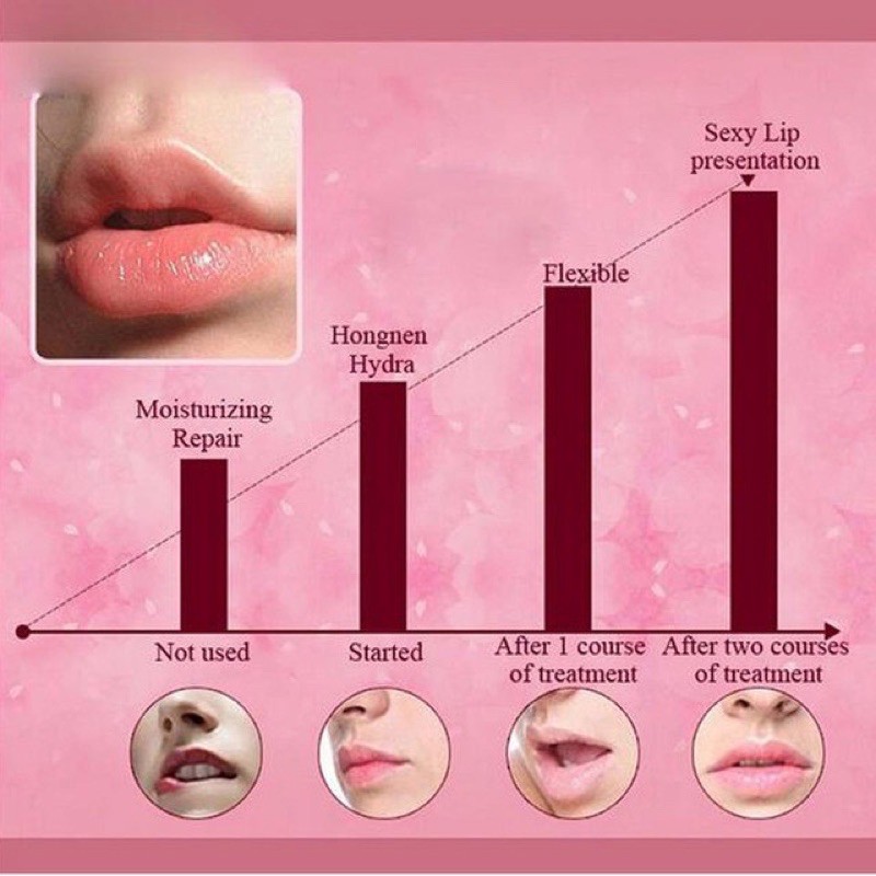 (hàng Mới Về) Mặt Nạ Môi Collagen Nuôi Dưỡng Môi Bioaqua | BigBuy360 - bigbuy360.vn