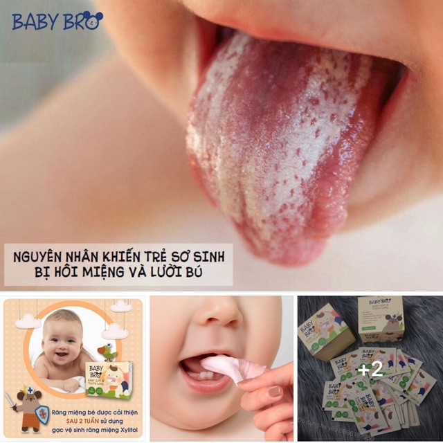 Gạc rơ lưỡi Baby Bro - Nhập khẩu Hàn Quốc - vệ sinh răng miệng cho bé - khăn lau răng Babybro [ babyboo]