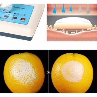 Máy Hút Chì 2 in 1 B628ll Có Đốt Nốt Ruồi , Mụn Thịt