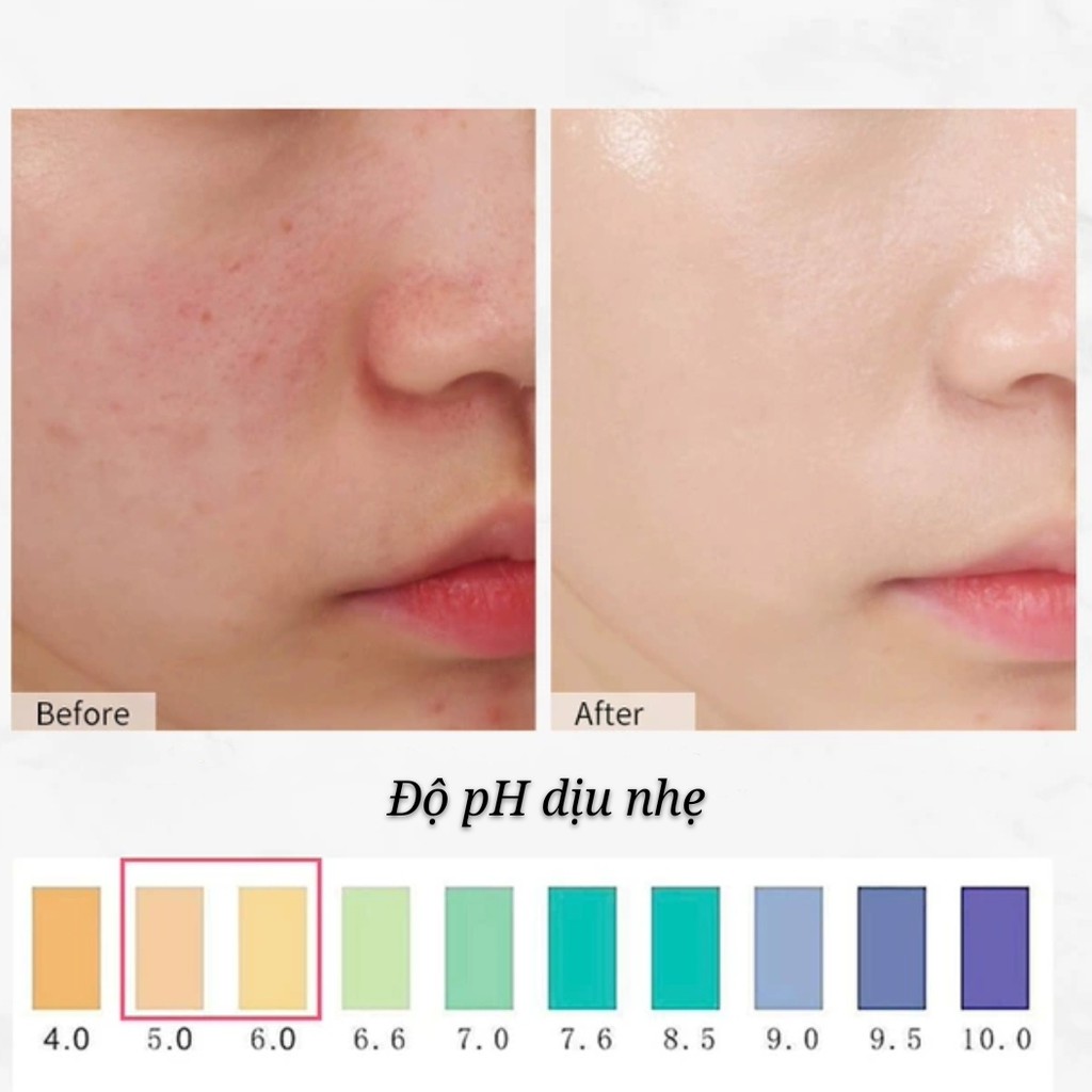 Nước hoa hồng BFACE SAMANLI  ngăn ngừa mụn ẩn se lỗ chân lông Rosemary Verbenone Hydrosol Verbena BFAC01 SAML04