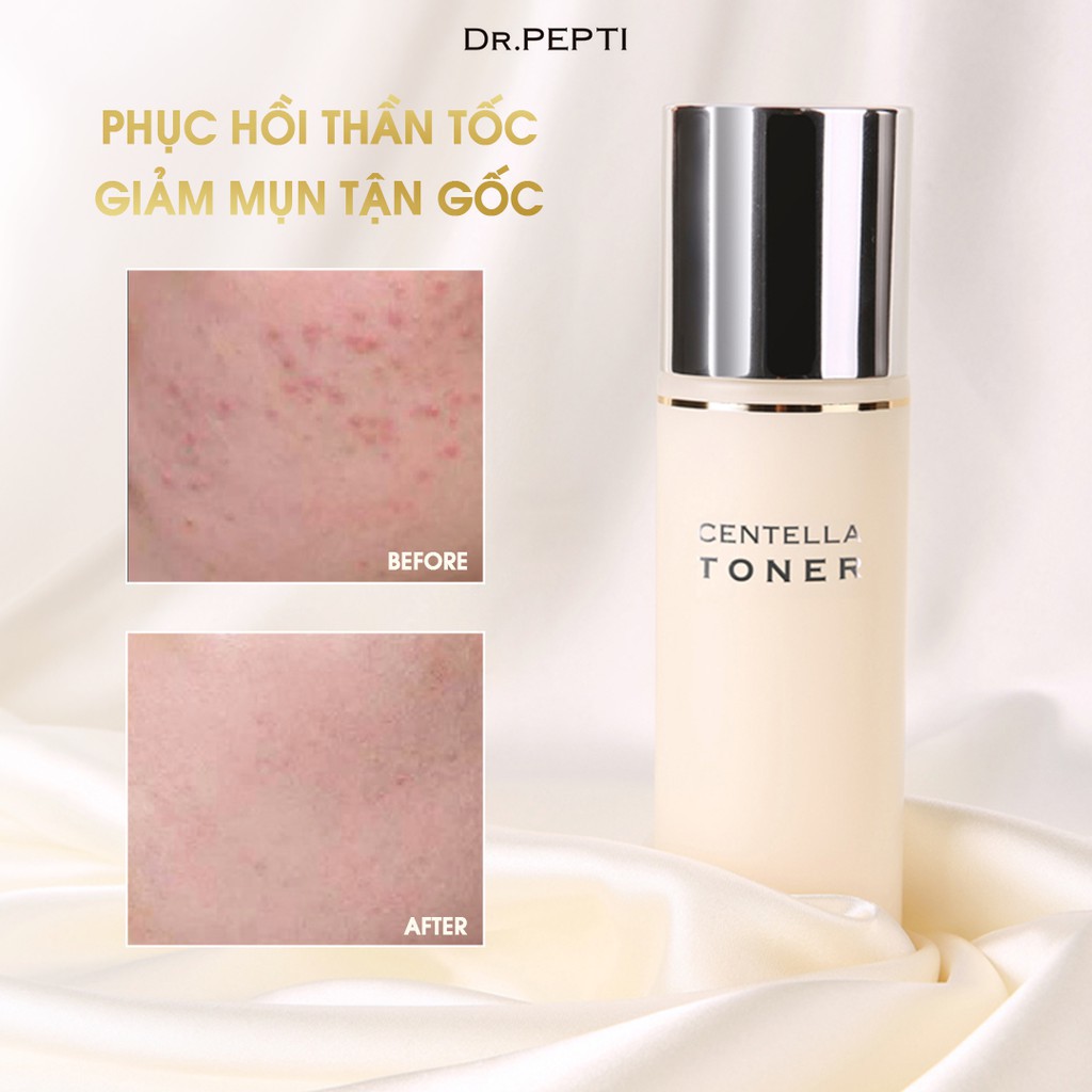 [Combo] Nước Hoa Hồng Dr.Pepti Centella Toner &amp; Tinh chất dưỡng trắng Dr Pepti Centella Dark Spot Solution Ampoule