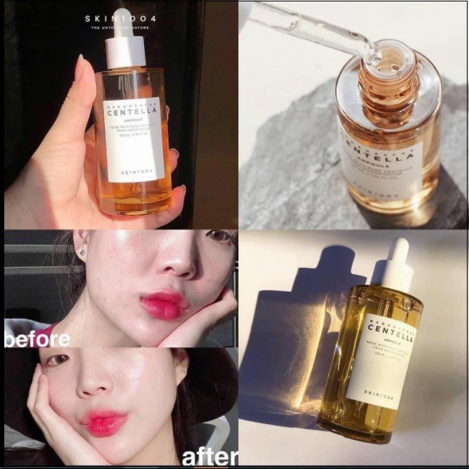 TINH CHẤT RAU MÁ SKIN1004 MADAGASCAR CENTELLAR AMPOULE | BigBuy360 - bigbuy360.vn