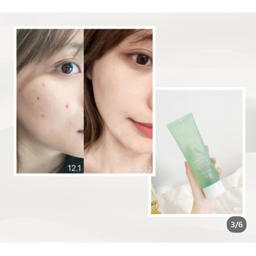 Gel lô hội Ruwei RNW dưỡng ẩm Hỗ trợ giảm mụn tái tạo da 250g/mL