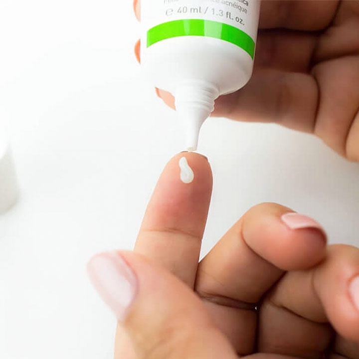 Kem dưỡng giảm nhờn, mụn se lỗ chân lông MartiDerm Acniover Cremigel Active 40ml