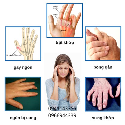 Nẹp ngón nhựa Envysleep cố định bảo vệ ngón tay, đứt gân ngón, bộ 1 cái