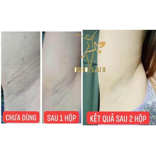 Siêu dưỡng thâm biholadi5s