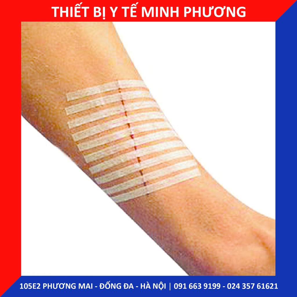 Băng keo dán lành vết thương 3M Steri-Strip