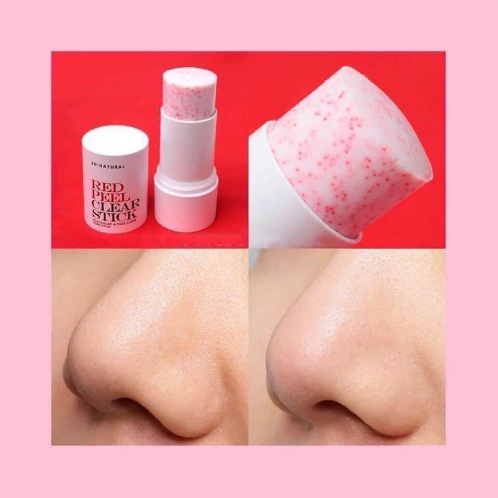 Thanh Lăn Hỗ Trợ Trị Mụn Đầu Đen So’Natural Red Peel Clear Stick