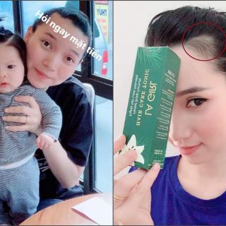 ♥️[Tặng Quà] LaGirl_Kích Thích Mọc Tóc♥️
