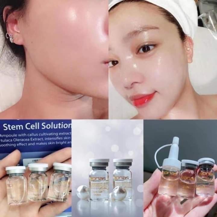 ( Hộp 10 lọ ) Tinh chất tế bào gốc Ronas Stem Cell Solution phục hồi dưỡng da hộp 10 lọ - CO208