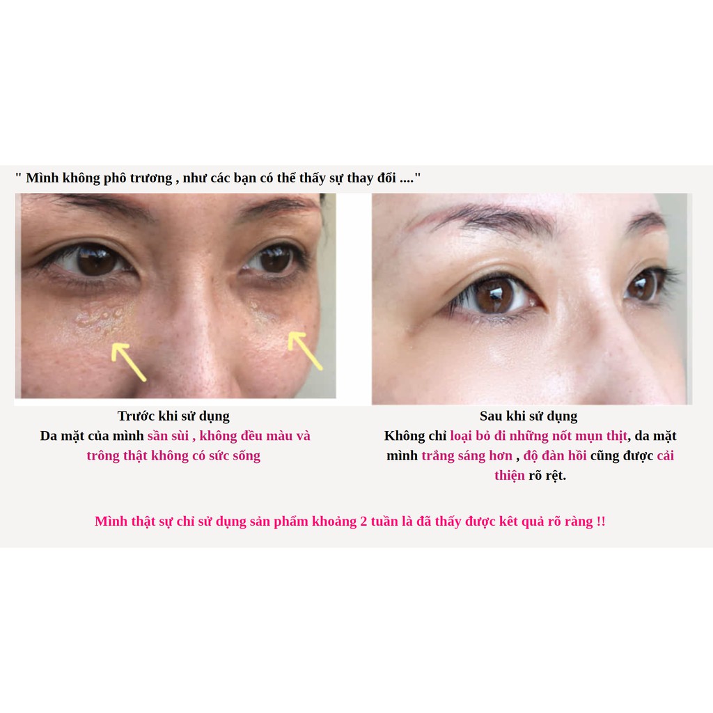 Gel dưỡng da EGF 5in1 Churacos Warabihada | BigBuy360 - bigbuy360.vn