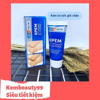 KEM TRỊ NỨT GÓT CHÂN KPEM NGA