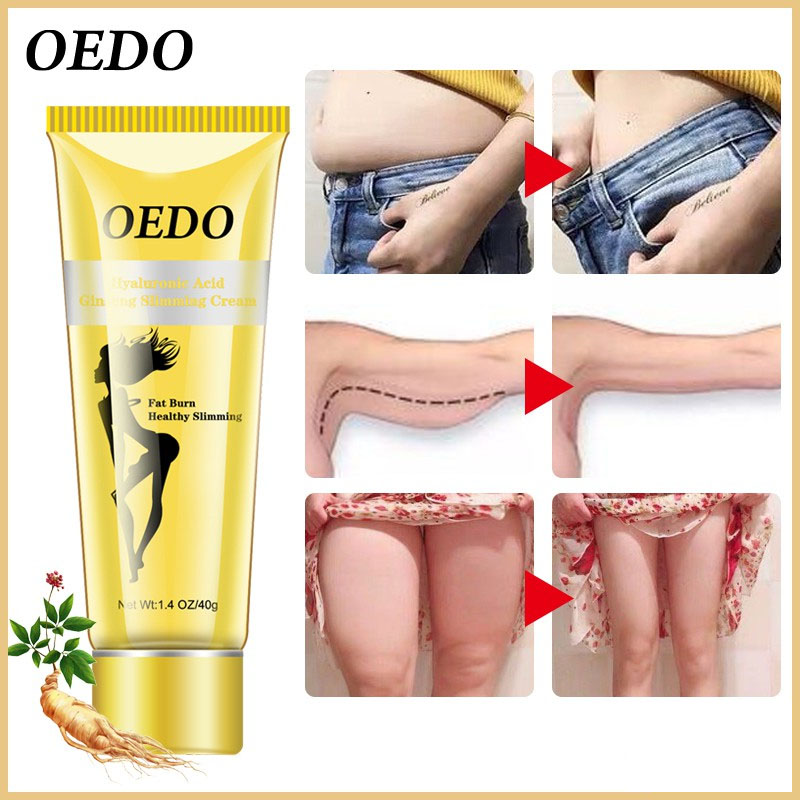 Kem Tan Mỡ Bụng OEDO Chứa Axit Hyaluronic Chiết Xuất Nhân Sâm Đốt Cháy Chất Béo Giảm Cân