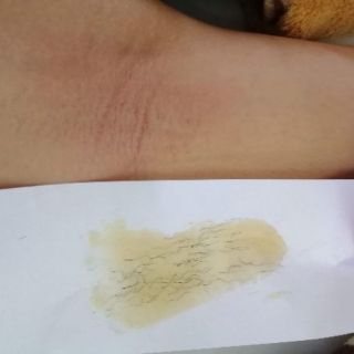 Combo wax Shiny triệt lông