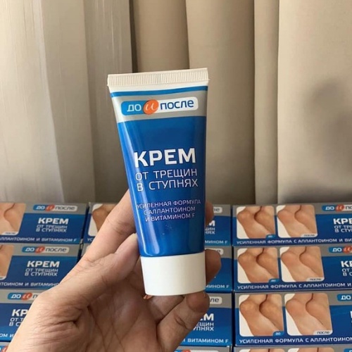 Kem bôi Nứt Gót Chân, Kem  Hồi Phục Nứt Nẻ Gót Chân Kpem Nga 50ml - Dưỡng Ẩm Và Làm Mềm Gót Chân Hiệu Quả